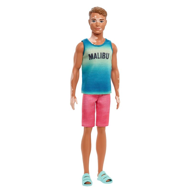 Barbie-Fashionista-Ken-Vitiligo---Mattel